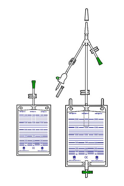 Gastric Lavage Kit - GASTROBAG